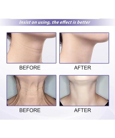  JIAOY Anti Wrinkle Firming Throat Cream Retinol Neck Cream Throat Reduction Anti-Aging Moisturizing Pencil Firming Moisturizing Face Cream for Neck (1PCS) - Buy Online on GoSupps.com