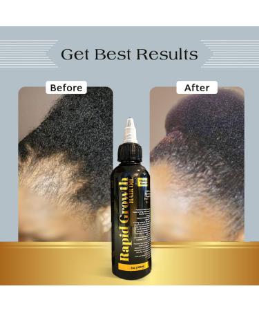 Premium Rapid Growth Hair Oil 100ml - Enhance Volume & Shine | Black & Gold - International Shipping Available - Buy Online on GoSupps.com
