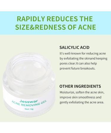 Jesswar Acne Treatment Face Cream - Cystic Acne Spot Treatment for All Skin Types (0.21 Oz) | Fast International Shipping - Buy Online on GoSupps.com