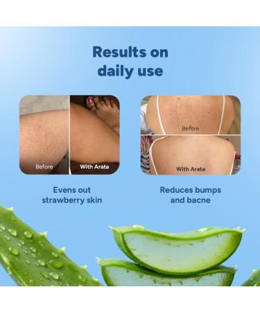 1% Salicylic Acid Body Wash for Bacne Bumpy & Strawberry Skin | Exfoliates Cleanses & Smoothens Uneven & Rough Skin | Paraben & SLS Free | Shower Gel For All Skin types (300ml) - Buy Online on GoSupps.com