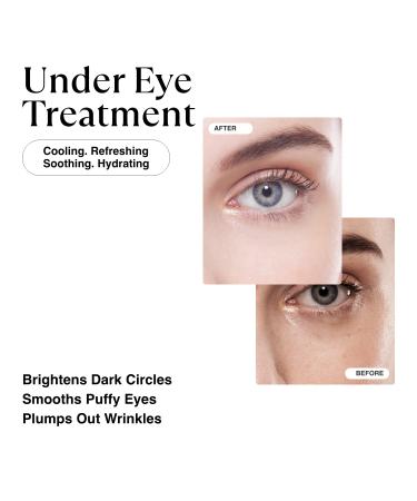 MATKAS Gold Under Eye Patches - Retinol, Hyaluronic Acid & Collagen for Dark Circles & Puffiness | Under Eye Mask Treatment for Women - Buy Online on GoSupps.com