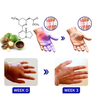 Gfouk Numbfix Hands and Foots Spray for Discomfort Caused by Joints Numbfix Hands and Foots Spray for Applies to Everyone Relieves Various Joint Pains (3pcs) - Buy Online on GoSupps.com