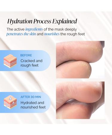 PLANTIFIQUE Foot Moisturiser Socks - Hydrating Foot Mask 2 Pack (with Box) Hydrating Socks for Soft Heels Intense Moisturizing and Repairing Dry Rough Skin Foot Care Korean Skincare - Mask Foot Spa - Buy Online on GoSupps.com