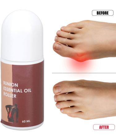 Natural 60ml Essential Toenail Roller Oil - Pain Relieving & Multi-Purpose Formula for Fast Repair - Buy Online on GoSupps.com