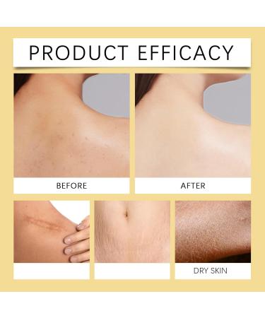 Vitamin E Oil - 75 000 IU Organic Vitamin E Oil for Cosmetics Firming Plump Skin Reducing Fine Lines Pure Vitamin E Oil for Skin Face & Body Vitamin E Drops 60 ml - Buy Online on GoSupps.com