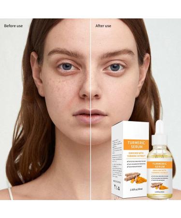 Buy Turmeric Serum for Dark Spots - Facial & Body Corrector Acne Treatment Pure Turmeric Oil Skincare for All Skin Types - Buy Online on GoSupps.com