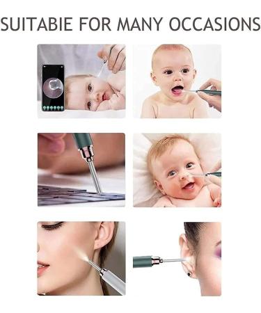 KouRy Portable Ear Cleaner with Camera - 1080P FHD Ear Wax Removal Tool for Kids & Adults Wireless Ear Cleaning Endoscope with LED Light - Buy Online on GoSupps.com