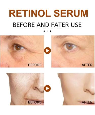  MagiSel Retinol Serum for Face Day at Night Care Face Serum with Retinol Hyaluronic Acid & Vitamin E Anti Aging Serum Moisturizing & Moisturizing Improve Facial Wrinkles - Buy Online on GoSupps.com