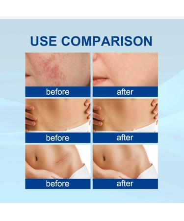 Scar Treatment Spray - Advanced Solution for All Scar Types (3pcs) | Effective Skin Care for Scars | Fast Shipping Worldwide - Buy Online on GoSupps.com
