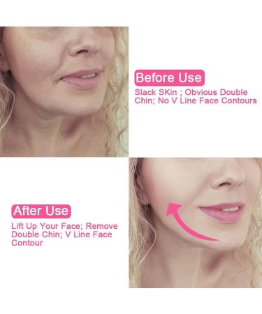 Face Slimming Cheek Belt Bandage Belt Mask Face-Lift Double Chin Skin Strap Jaw Support Facial Lifting Strap Belt for V Face Line Slim - Buy Online on GoSupps.com