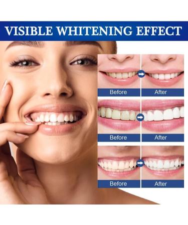 Pemarlis Teeth Whitening Pen - 2 Pack Bleaching Gel for Fast Effective Stain Removal & Gentle Whitening - Buy Online on GoSupps.com
