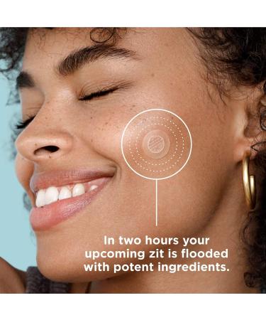 ZitSticka Killa Kit | Self-Dissolving Microdart Acne Pimple Patch for Blind, Early-Stage Zits | Spot Targeting for Face and Skin | 8 Pack - Buy Online on GoSupps.com
