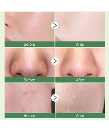 Anguishil Green Tea Mask Stick for Face - Deep Cleanse & Blackhead Remover Mask Stick - Oil Control & Skin Improvement for Women & Men (1 PCS) - Buy Online on GoSupps.com