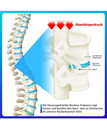 Decompression Lumbar Belt for Waist Support | Posture Correction & Back Pain Relief - Buy Online on GoSupps.com