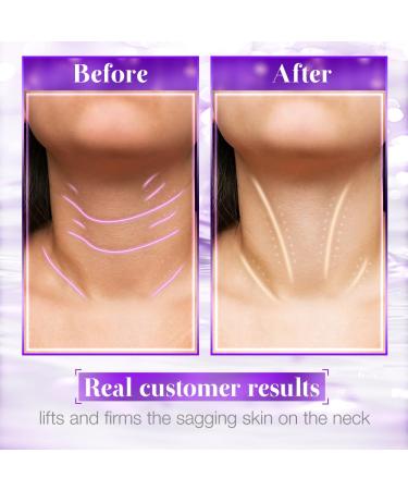 Neck Firming Cream Tighten & Lift Moisturizer for Wrinkles and Loose Skin Anti-Aging for Chest & Double Chin - Buy Online on GoSupps.com