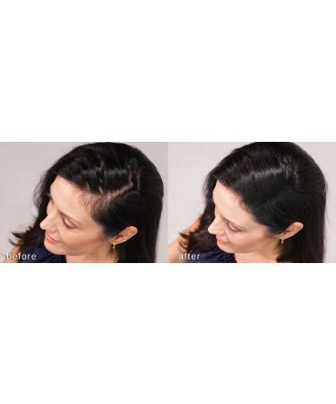 LUXE Hair Thickening Fibers - 2 Months+ Supply in Gray | Hypoallergenic & Dermatologist Tested for Confidence Boost - Buy Online on GoSupps.com