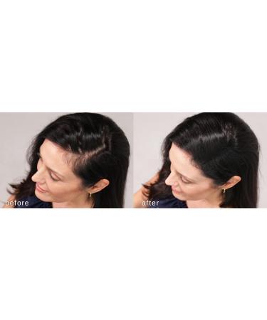LUXE Hair Thickening Fibers - Confidence in a Jar - 2 Months Supply Hypoallergenic & Dermatologist Tested - Multiple Colors Available (Medium Blond) | International Shipping - Buy Online on GoSupps.com