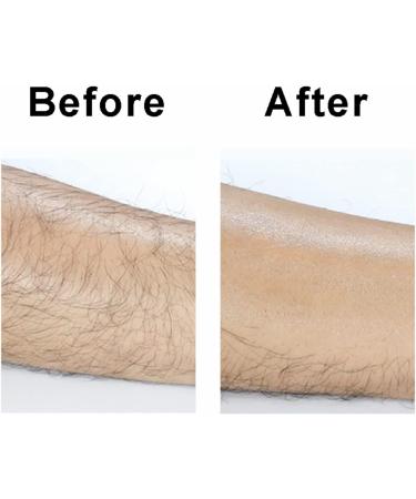 Crystal Hair Eraser - Painless Hair Remover for Women and Men | Exfoliation Tool for Arms, Legs, and Back | Reusable & Washable Epilator (Blue) - Buy Online on GoSupps.com