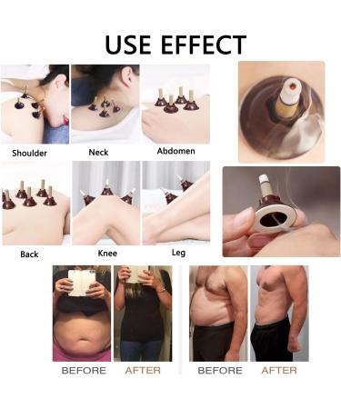 Moxa Sticks for Moxibustion Moxibustion Sticks 50/100/150Set Moxibustion Gathering Energy Burning Column Moxa Stick Moxa Box Moxa Heat Pack Moxibustion Box with Self-Stick Base (100Set) - Buy Online on GoSupps.com