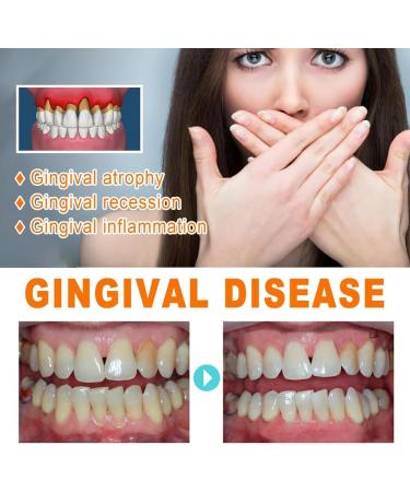 Buy Gum Repair Treatment Ampoules - Oral Repair Serum for Tartar Removal | 2 Boxes of Effective Gum Repair and Tooth Whitening Essence - Buy Online on GoSupps.com