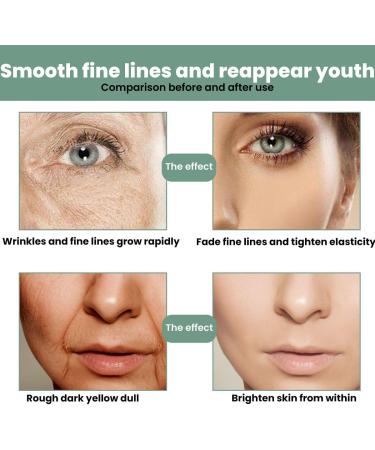 S rum anti- ge au collag ne avanc s rum anti- ge hydratant et nourrissant contient de l'acide hyaluronique et de la vitamine C raffermit la peau am liore l' lasticit (1 pi ce) 1 pi ce. - Buy Online on GoSupps.com