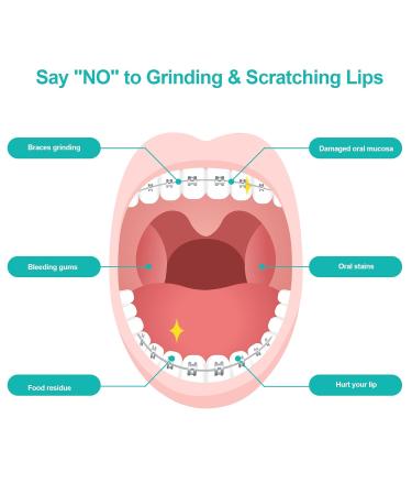 10 Boxes of AnnHua Orthodontic Wax for Braces - 50 Strips in 10 Flavors Ideal for Wire Brackets - International Shipping Available - Buy Online on GoSupps.com
