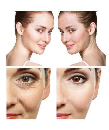 Dead Sea Mineral Mud Mask Lavender Scented - 100% Natural - Minimize Pores, Remove Blackheads, Reduce Acne & Wrinkles - 8.8 oz - Buy Online on GoSupps.com