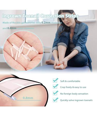 KINDOYO Correction Ingrown Toenails Set - 40 Pieces Painless Toenail Smoothing Strips with Toenail Lifter - Simple Tool Set for Ingrown Toenails - Buy Online on GoSupps.com