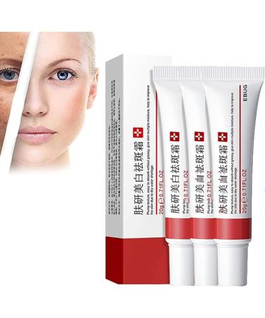 SGHOPLG 3Pcs Effective Whitening Freckle CreamRemove Melasma Acne Cream Fading Spot CreamAcne Scar Removal TreatmentFade Pigmentation Anti Melasma Brighten Skin Care Creams