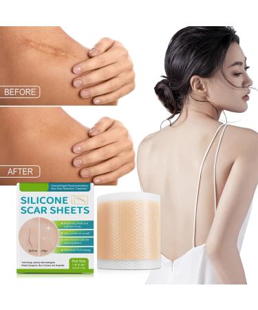 Silicone Scar Tape Roll - Self-Adhesive Patch for Acne Scars and Skin Repair (3pcs) - Buy Online on GoSupps.com