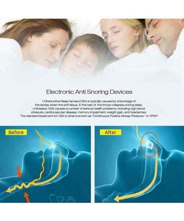 Adjustable 3-Speed Electric Anti-Snoring Device for Men and Women | Nasal Dilator for Better Sleep | Includes Fixing Strap | White - Buy Online on GoSupps.com