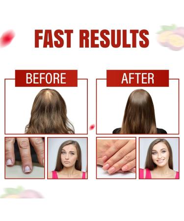 Aurisova Everyday Glow Biotin 6000mcg & Marine Collagen Gummies | Advanced Dietary Supplement for Hair Skin and Nails Vitamins with B-Complex Zinc Vitamin C & E | Passion Fruit Non-GMO 60ct - Buy Online on GoSupps.com
