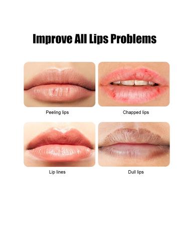 VERONNI 24K Gold Lip Mask - Hydrating Lip Plumper with 30 Patches for Smoother, Firmer Lips - Moisturizing and Nourishing Formula to Minimize Fine Lines - Buy Online on GoSupps.com