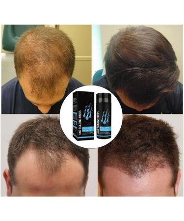 Hair Building Fibers Hair Building Fibres Powder Hair Fibres Dark Brown Hair Fibres For Thinning Hair Hair Loss Concealer Fiber Hair Building Fibres & Hair Fibers (Dark Brown) - Buy Online on GoSupps.com