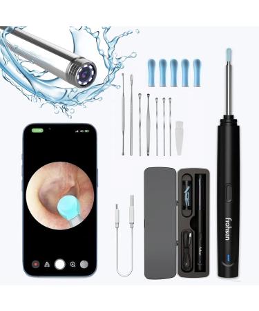 Frohsen Ear Wax Removal Kit Otoscopes Visual Smart Ear Cleaner with Real Time HD Camera Light Ear Scope Cleaning Kits Ear Wax Remover iOS & Android Systems Supported