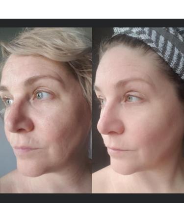 Anti-Aging Night Cream for Face and Eyes - Anti-Wrinkle - Skin Restoration - 50ml - Buy Online on GoSupps.com