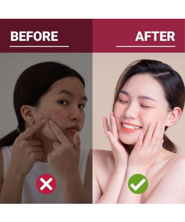 New Roots Herbal - Evening Primrose Oil 1 000mg - 90 Softgels - Organic Evening Primrose Oil - Evening Primrose Oil for Skin - Evening Primrose Oil Organic - Evening Primrose Oil Supplement - Eczema/Acne 90 count (Pack of 1) - Buy Online on GoSupps.com