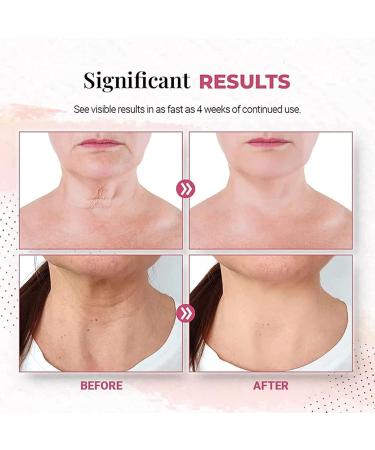  2 Jars Soonpure Bright Cream For Neck Neck Firming Cream Tightening Lifting Sagging Skin Neck Lift Neck Firming 150g - Buy Online on GoSupps.com