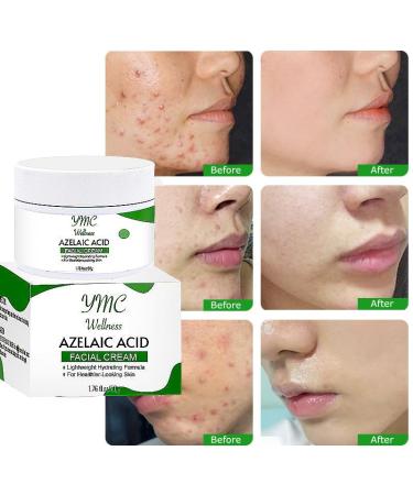 Azelaic Acid Face Cream for Acne Brightening & Skin Tone Correction | Oil Control Paraben-Free Cruelty-Free - Buy Online on GoSupps.com