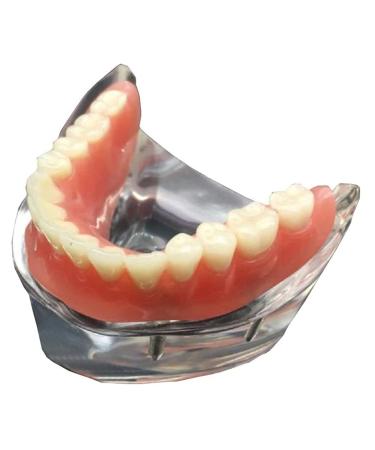 ESBANT Anatomy Teeth Model Dental Teeth Model Teeth Study Teaching Demonstration Model Dental Care Model Home