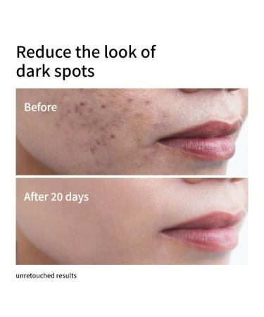 Niacinamide 10% + Zinc 1% Face Serum| Advanced Skin Tone & Oil Control| Hydrating & Anti-Blemish Formula| Lightweight & Fast-Absorbing 30ml - Buy Online on GoSupps.com