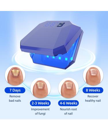 Nail Fungus Cleaning Device for Onychomycosis Nail Fungus Treatment for Fingernails Effective Convenient Toenail Nail Fungus Treatment for Home Use (Blue) - Buy Online on GoSupps.com