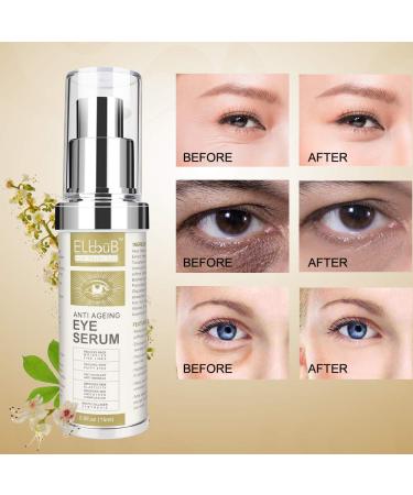 Anti Ageing Eye Serum: Reduce Wrinkles, Dark Circles & Puffy Eyes - Buy Online on GoSupps.com