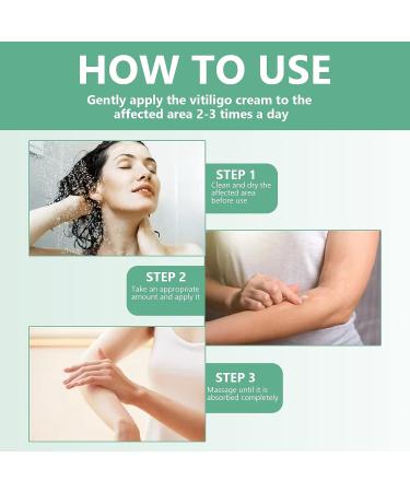 Vitiligo Care Cream - Natural Treatment for Skin Pigmentation | Reduce White Spots, Improve Skin Tone - Buy Online on GoSupps.com