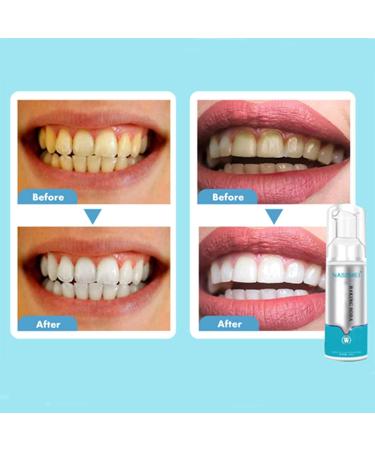 Deep Cleaning Foam Toothpaste Powerful Stain Removal Toothpaste Toothpaste Cleaning Foam Baking Soda Foam Whitening Toothpaste - Buy Online on GoSupps.com
