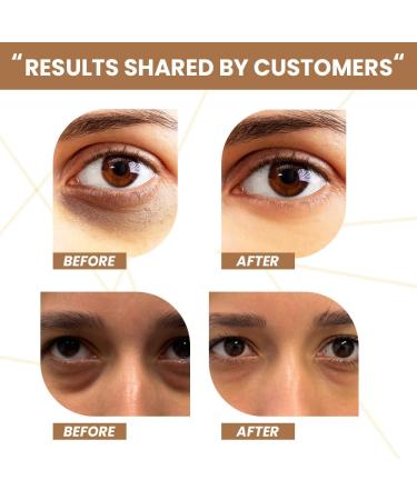 R.a.w.l.s Coffee Under Eye Cream for Dark Circles & Puffiness - 360 Massage Roller with Caffeine & Vitamins | 15 ML - Ideal for Men & Women - Buy Online on GoSupps.com