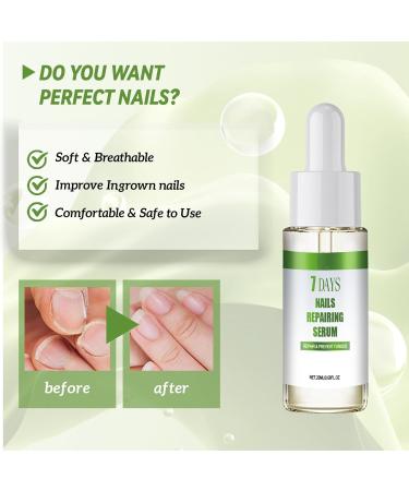 7 Days Nails Repairing Serum Nail Growth Treatment Nail Serum For Strength And Growth Toenail Strengthener For Damaged Nails Restores The Healthy Natural Appearance Of Nails (1) - Buy Online on GoSupps.com