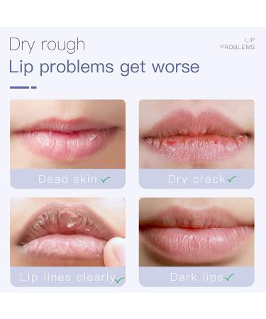 Lip Exfoliator Scrub for Dark and Chapped Lips - Gentle Treatment with Moisturizing Benefits - Buy Online on GoSupps.com