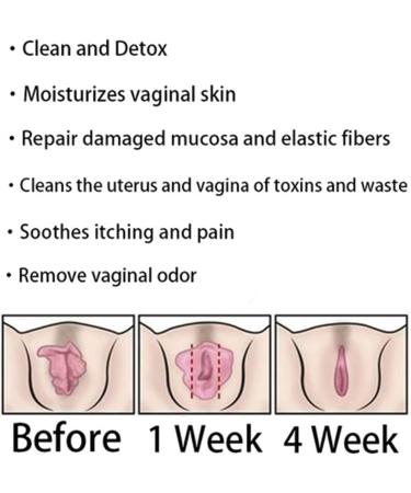 Annie Care Natural Detox Vaginal Gel | Instant Anti-Itch Relief & Slimming Products - Anniecare Vaginal Capsules for Natural Repair - Buy Online on GoSupps.com