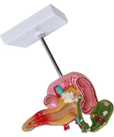 Duodenal Biliary and Pancreatic Model - Duodenal Model - Gallbladder Pathology Digestive System Model Tool Science Teaching Toy Model - Buy Online on GoSupps.com